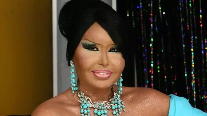 73 Yaşındaki Bülent Ersoy Açtı Ağzını Yumdu Gözünü! Tokatlayıp Yataktan Atarım.." - Resim: 4