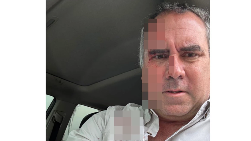 Siyasi isme suikast girişimi! - Resim: 2