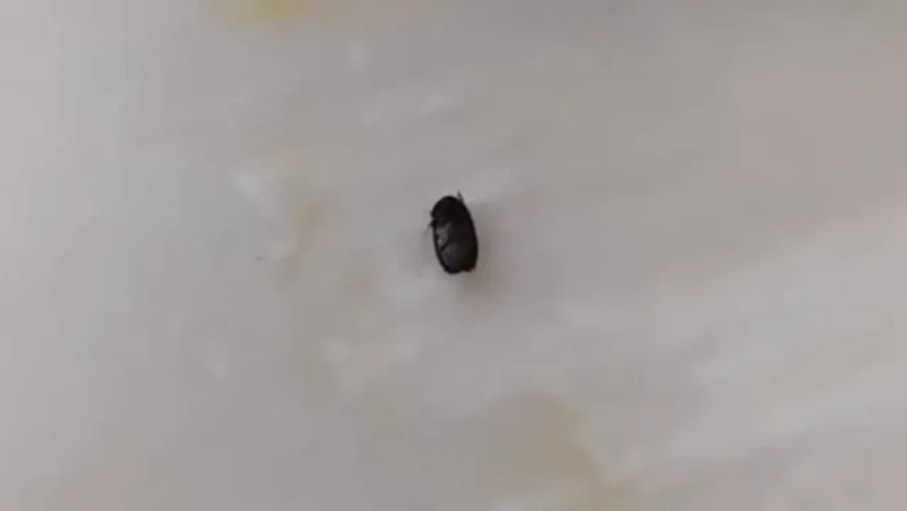 İzmit’te kene paniği… 3 yaşındaki çocuğa parkta kene yapıştı - Resim : 2