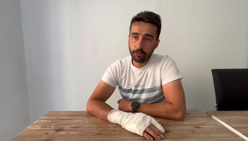 Cep telefonu bataryası bir anda patladı: O anlar güvenlik kamerasında - Resim : 1