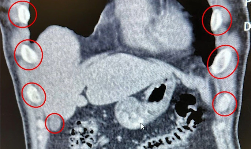 Midelerinden çıkan "Yok artık" dedirtti! - Resim : 2