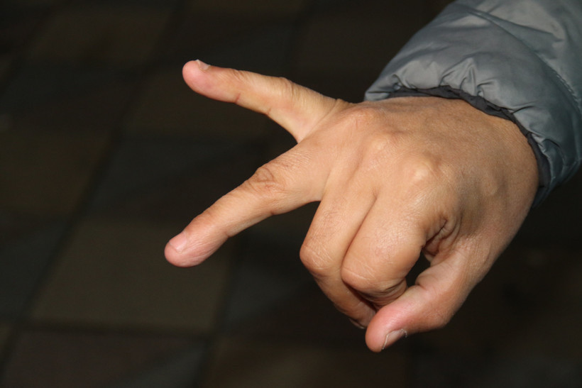 Müşteriyi balıkla dövdüler! Talihsiz adam parmağından oldu - Resim : 2