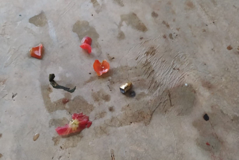 Balkonda oturan çocuğa kurşun isabet etti! - Resim : 3