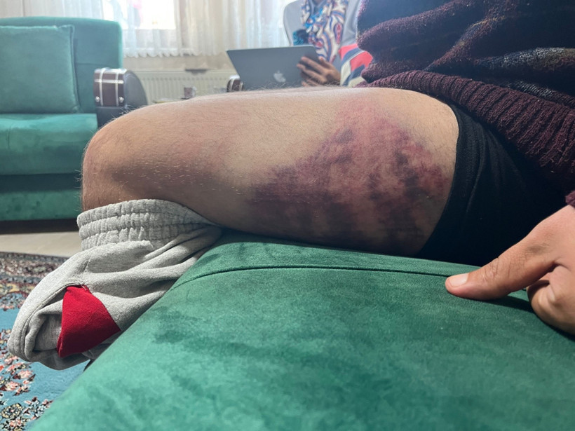 Vicdanları yaralayan olay: Savunmasız otizmli şahıs darbedildi! - Resim : 3