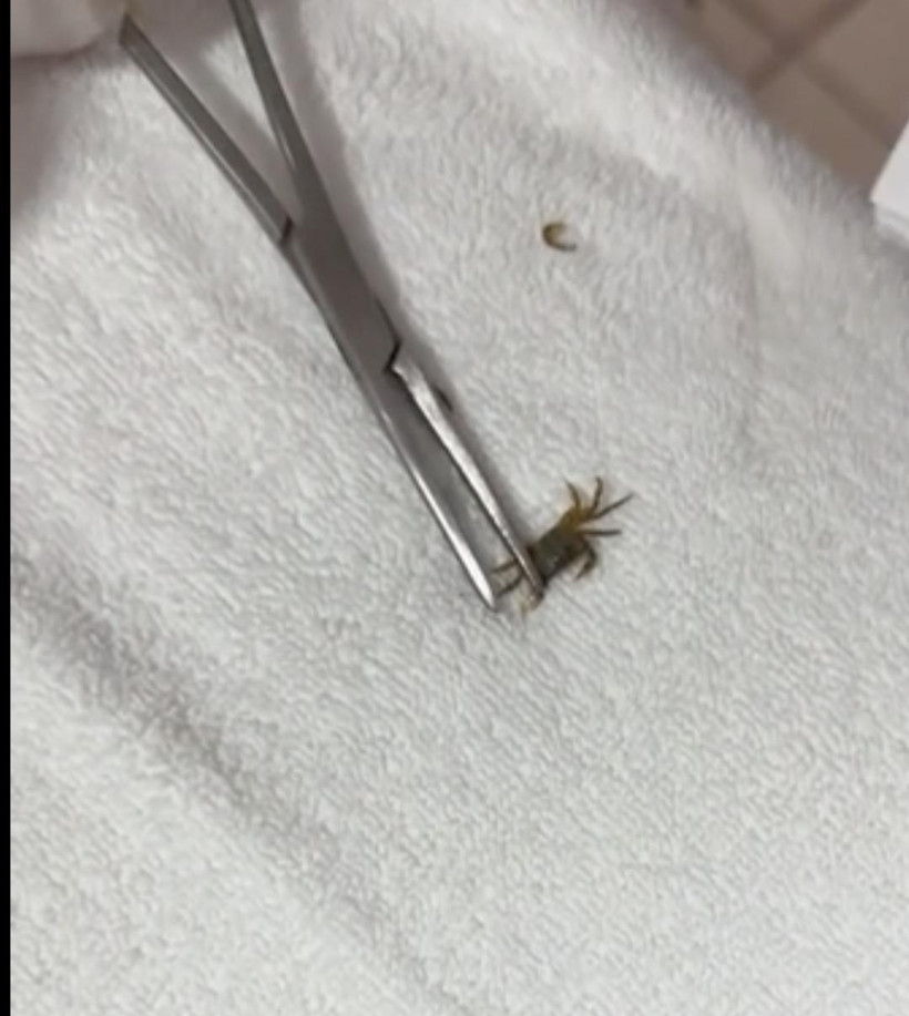 Akıl almaz olay! Kulağından çıkan şey küçük çocuğa kabusu yaşattı! - Resim : 1